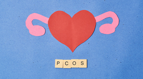 Polycystic ovary syndrome (PCOS) is a hormonal disorder that affects many women worldwide.